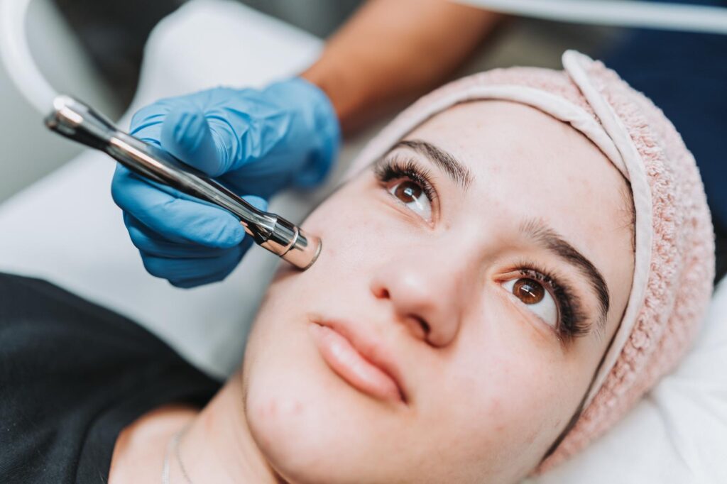 Diamond Dermabrasion